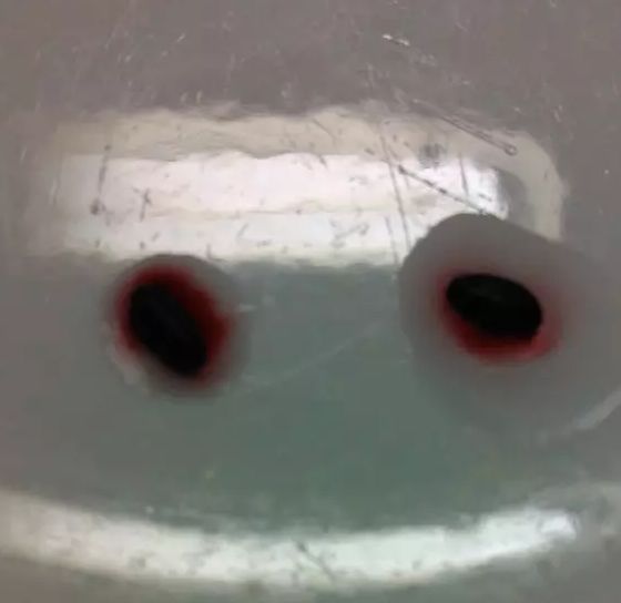 神明液体+鸡蛋+核桃油+白醋！上锅焖2个小时！让人大吃一惊