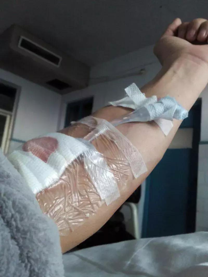 每天跑步五公里治愈癌症,有氧跑步战胜癌症的案例