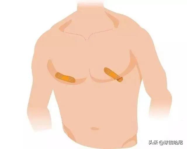 马拉松运动员如何避免伤痛,马拉松流血