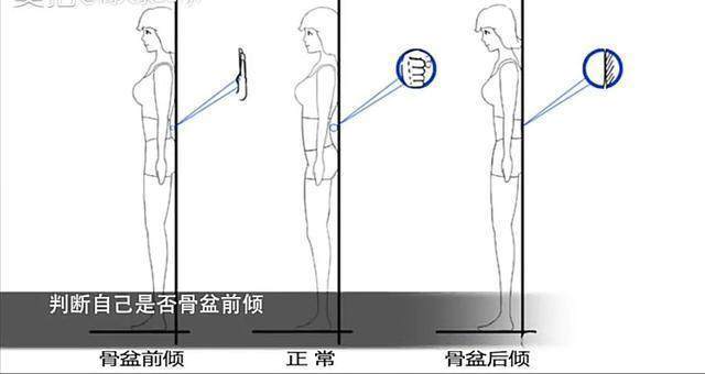 如何快速纠正o型腿,40岁男性o型腿可以矫正过来吗