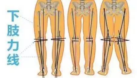 娃儿经常喊脚痛,娃儿老是喊脚软怎么回事