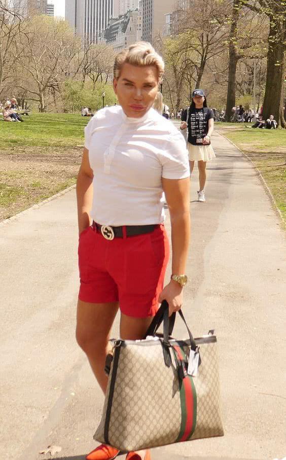 巴西男整容42次图片,巴西男模花数百万整容