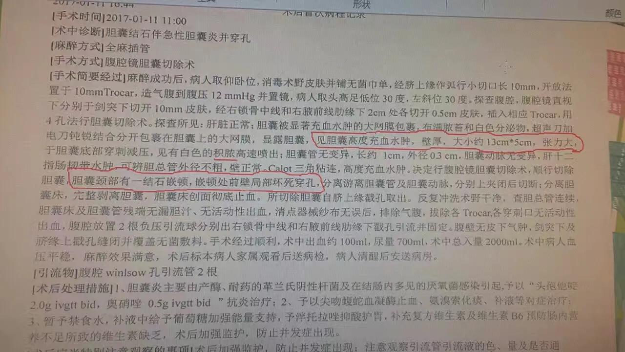 一公分胆结石并且引发急性胆囊炎,一颗胆结石必须摘胆吗