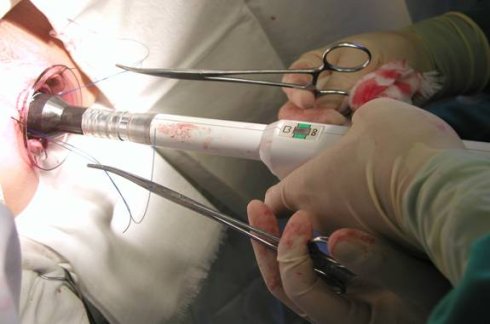 中医和西医治痔疮哪个比较好,中医和西医哪个治痔疮效果好