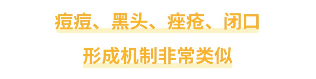 痘痘能不能挤会不会留坑,痘痘到底能不能挤