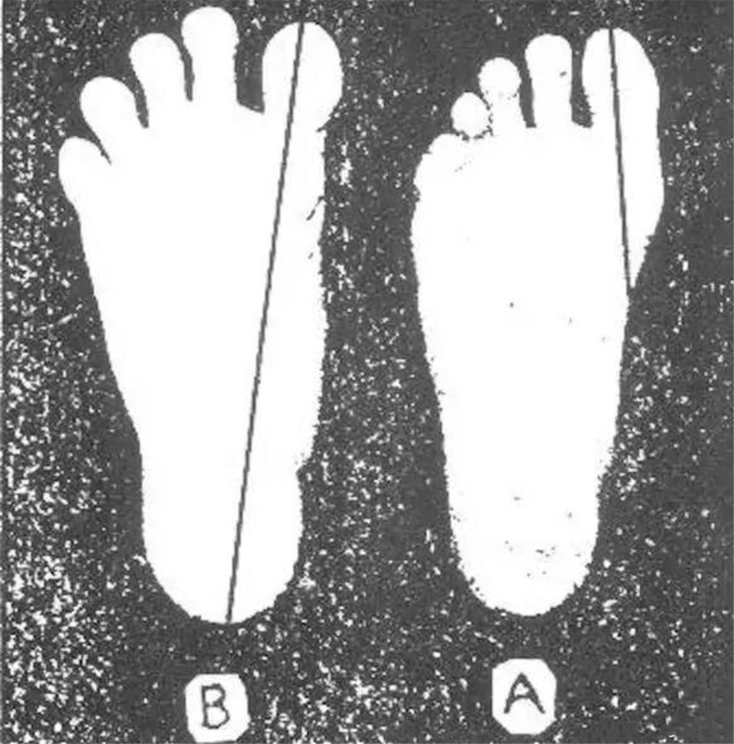 小孩怎么脱袜子脱鞋,小朋友爱脱袜子怎么把脚扎破的