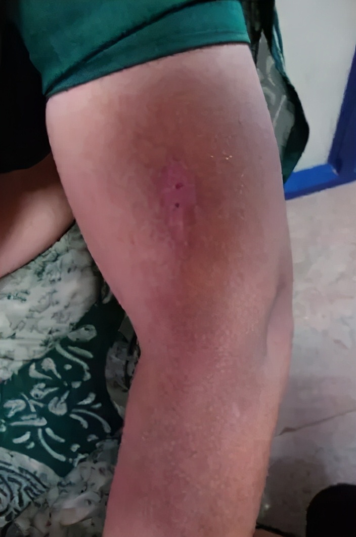 小米生态进军“搓澡业”?电动“小手”自动搓泥,不费力身体变白