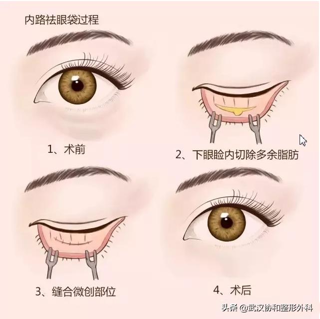 上海九院整形和协和整形,北京协和整形医院美容整形价格