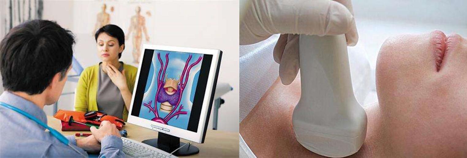 甲状腺超声TI-RADS,甲状腺TI-RADS分级标准有哪几个