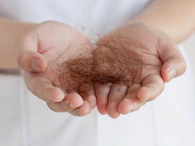 严重脱发都快秃了怎么办,第一批90后30岁了脱发脱成秃子