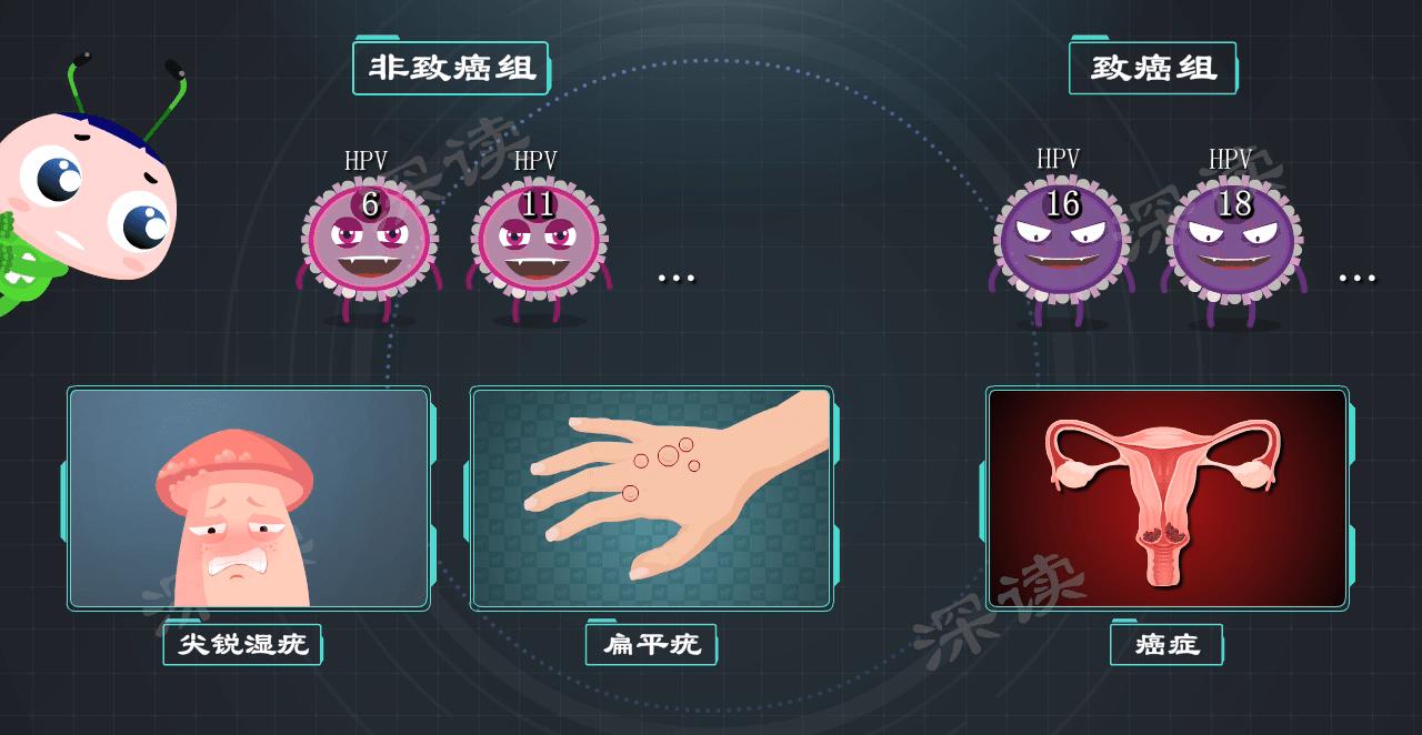 尖锐性湿疣都是hpv感染吗,尖锐性湿疣会引起hpv感染吗