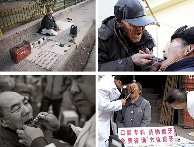 牙医拔牙的几种方法,作为牙医会拔牙是不是基本操作