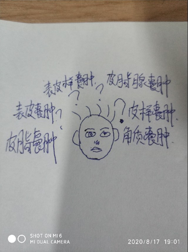 皮脂囊肿简介,皮脂囊肿和脂肪囊肿的区别