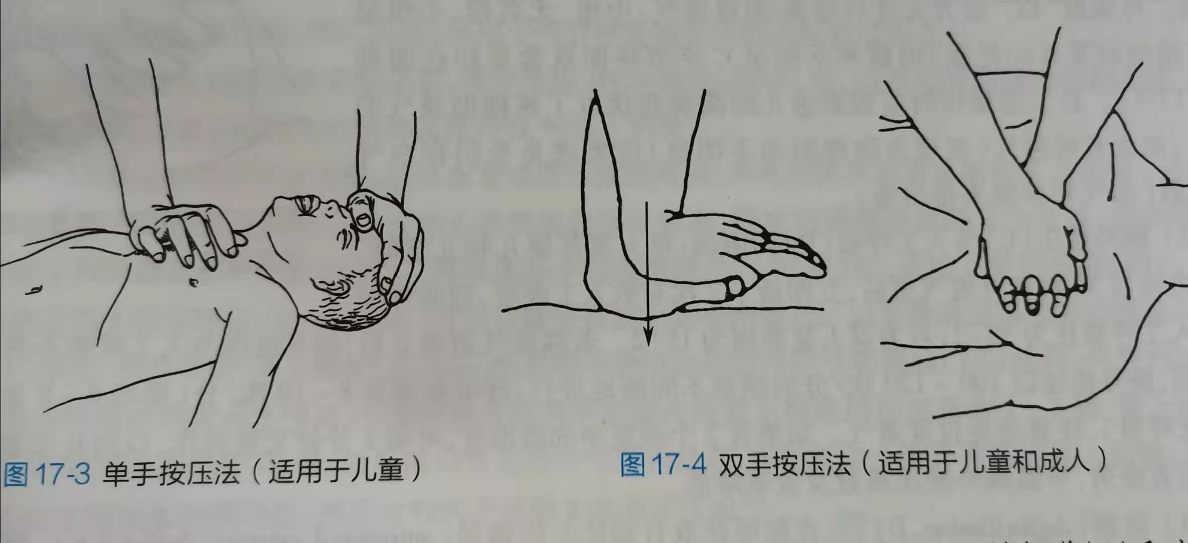 盘江总医院:家长们注意了!藏在幼儿衣物里的“隐形杀手”不容忽视