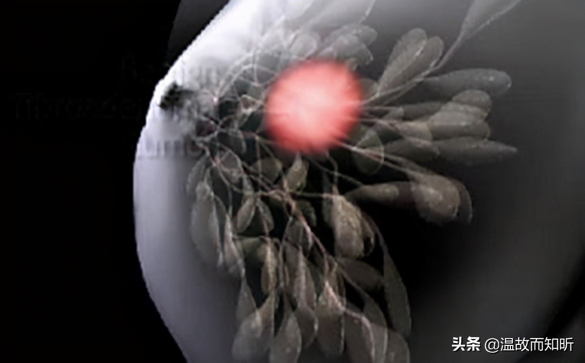 母女都是乳头内陷，检查出来的结果却不相同