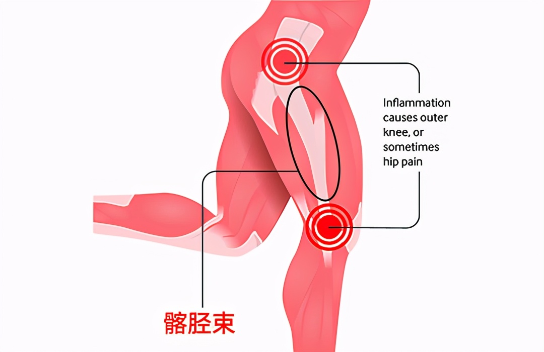 臀肌太发达翘不起来二郎腿,臀肌无力翘不上二郎腿