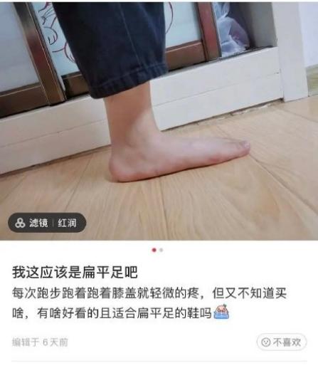 扁平足无足弓自己如何足部训练,足部外翻和扁平足会引起哪些改变