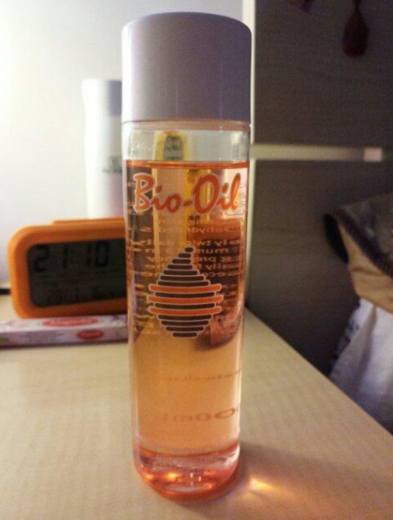 有妊娠纹不要怕一招教您轻松淡化,妊娠纹防不胜防你知道如何修复吗