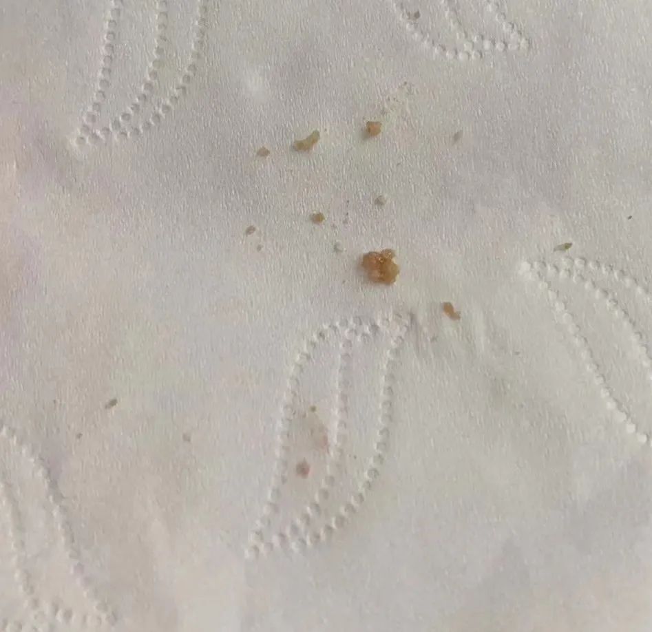 患者慕名而来,徐州哪家医院能做体外冲击波碎石