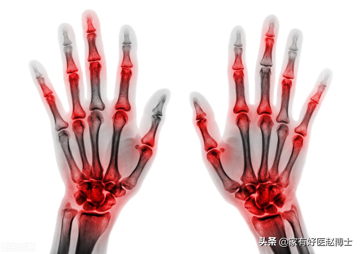 血脂血压尿酸都高如何治疗,血压血脂血糖尿酸哪个更严重