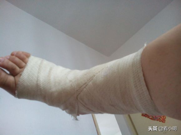 旅行社旅游团摔伤,报团旅游过程中受伤