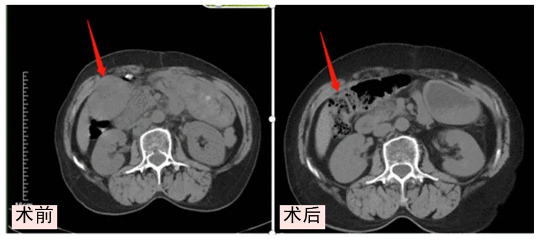 医播报,病例讲解