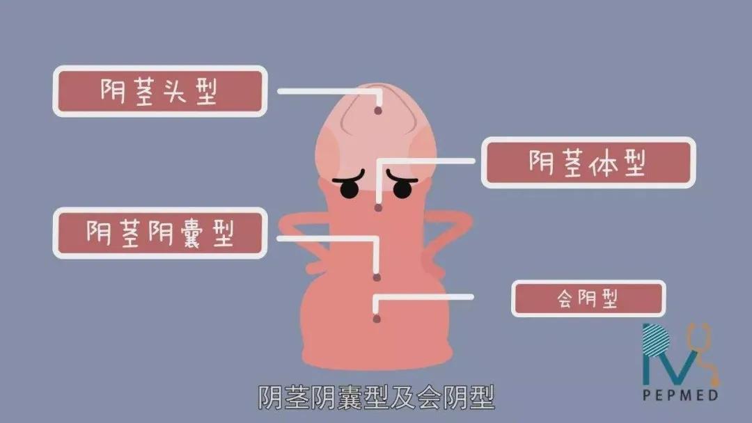 泌尿生殖健康科普知识,泌尿系统疾病科普知识