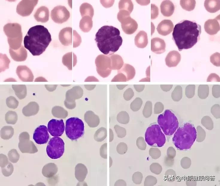 小小血常规,隐藏大奥秘