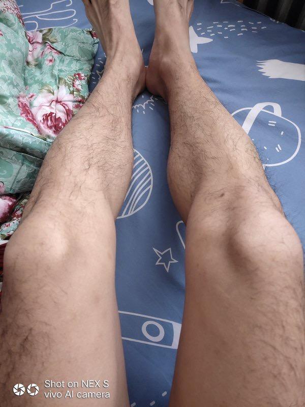 自觉心里不舒服是焦虑症吗,焦虑症总是自觉身体不适