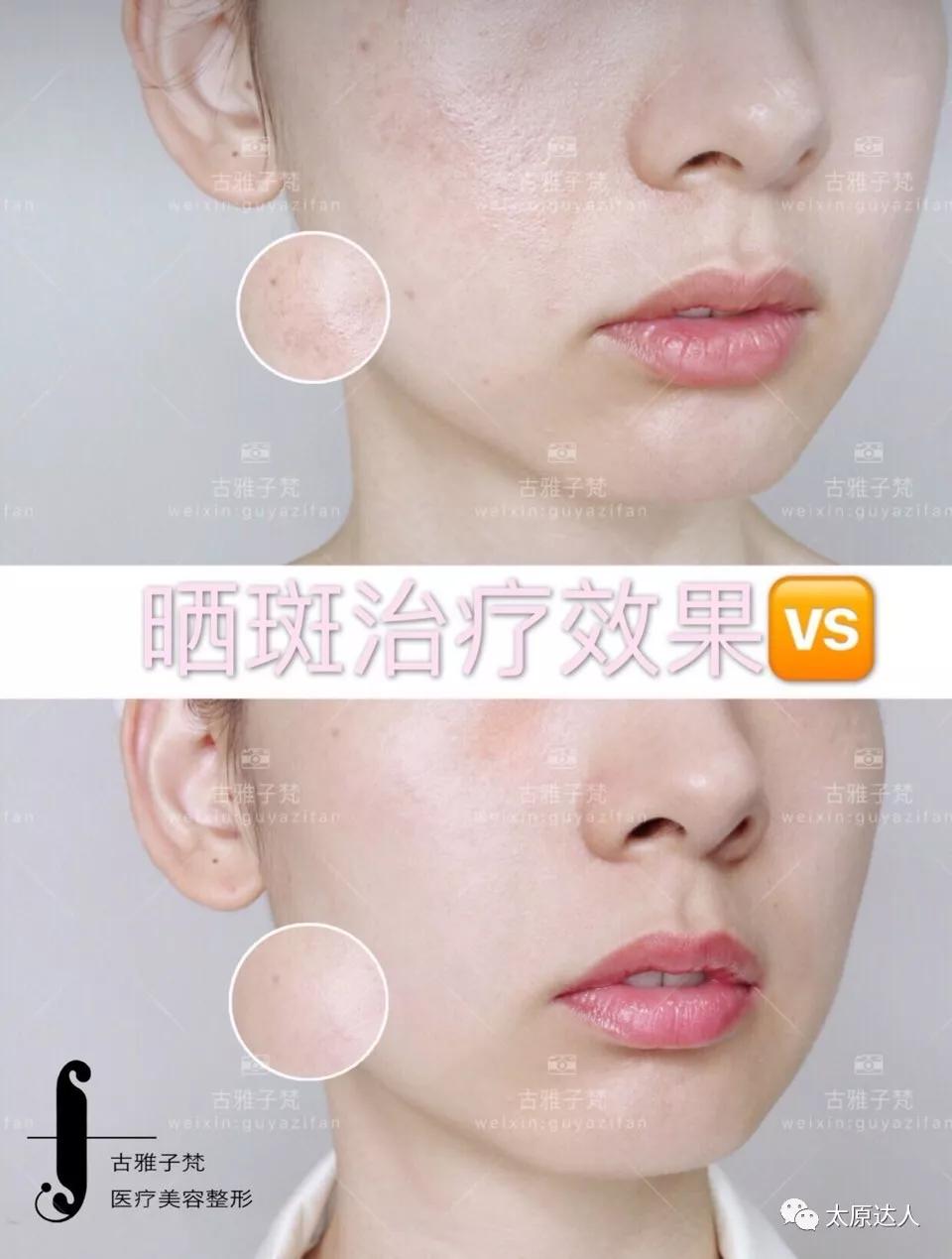 814元人气精华护理免费做！一次就焕颜新生！聚会女王就是你