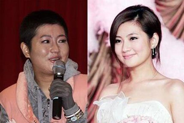 任家萱烧伤前后对比图片,任家萱烧伤时的视频