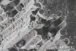 纤维桩修复费用,纤维桩修复全过程视频