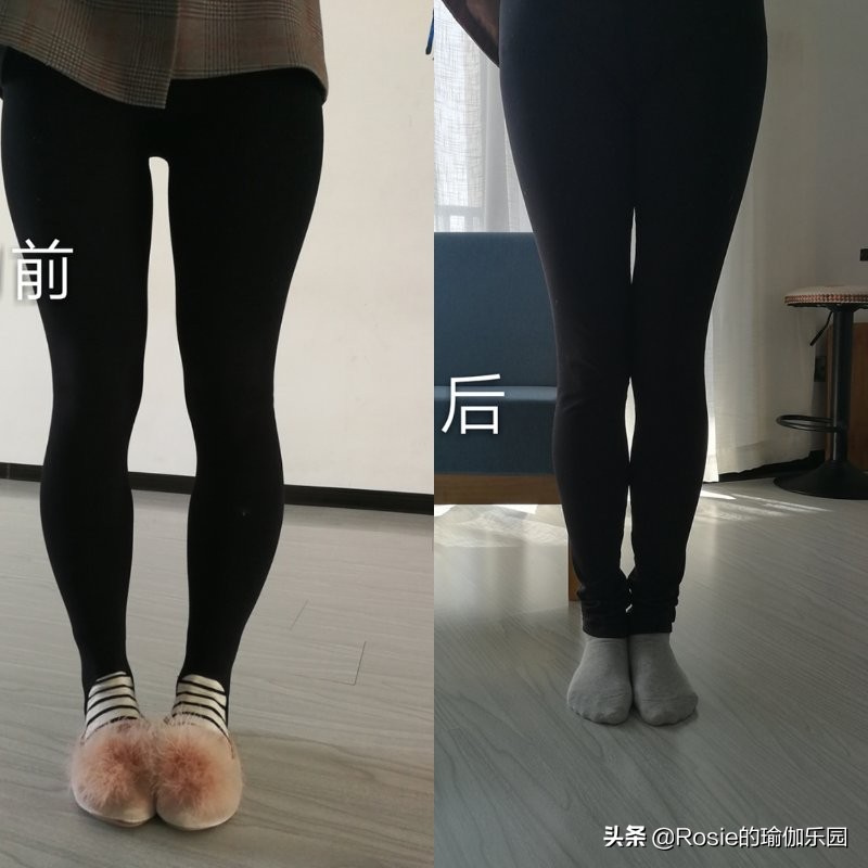 在腿上打瘦腿针20多针,瘦腿针多久能打第二针