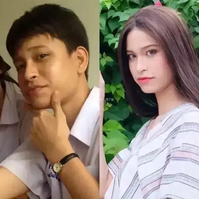 泰国整容的成功案例,全球整容技术最好的地方