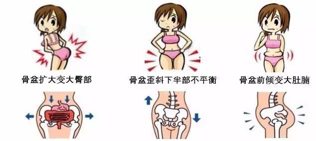骨盆歪造成的脸歪能恢复吗,骨盆为什么会前倾最快纠正法