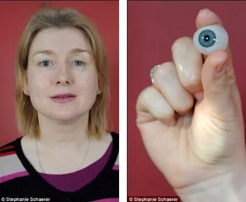 长期戴隐形眼镜眼睛里长满了溃疡,戴隐形眼镜长寄生虫前有哪些症状