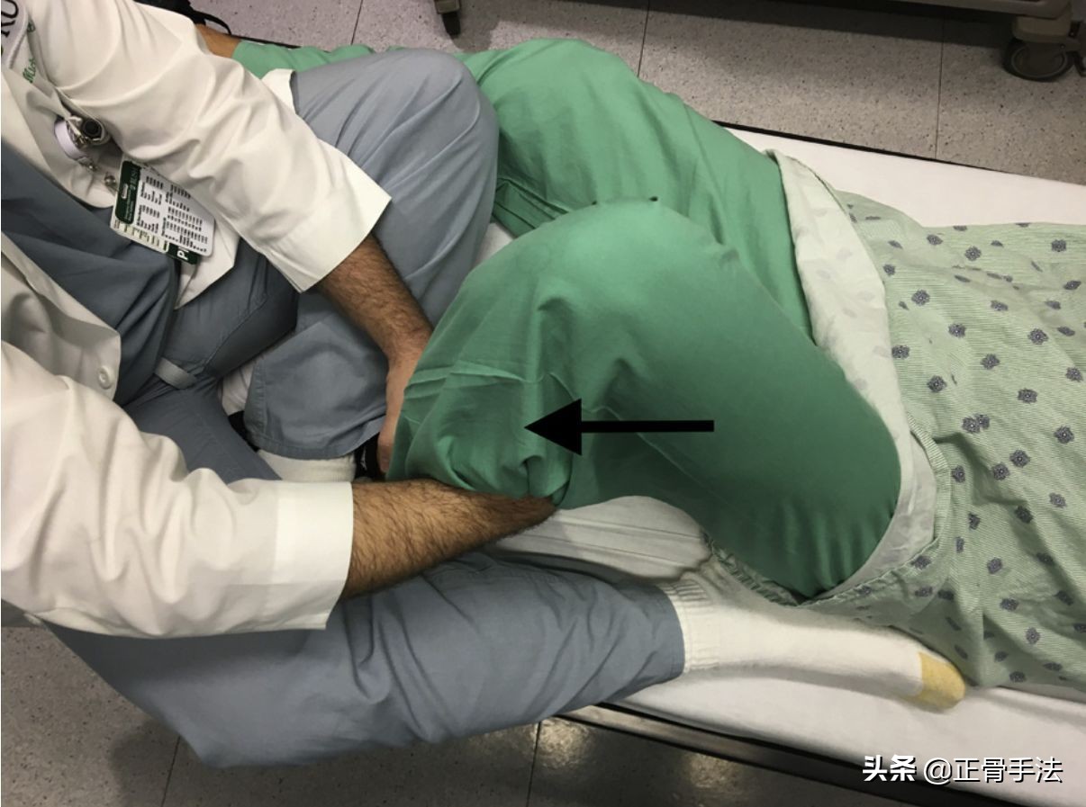 成人髋关节脱位可以去正骨吗,髋关节脱位手法复位描述