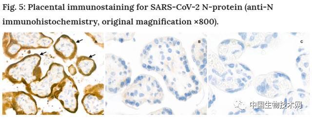 首例新型冠状病毒患者来源,首例新冠病毒