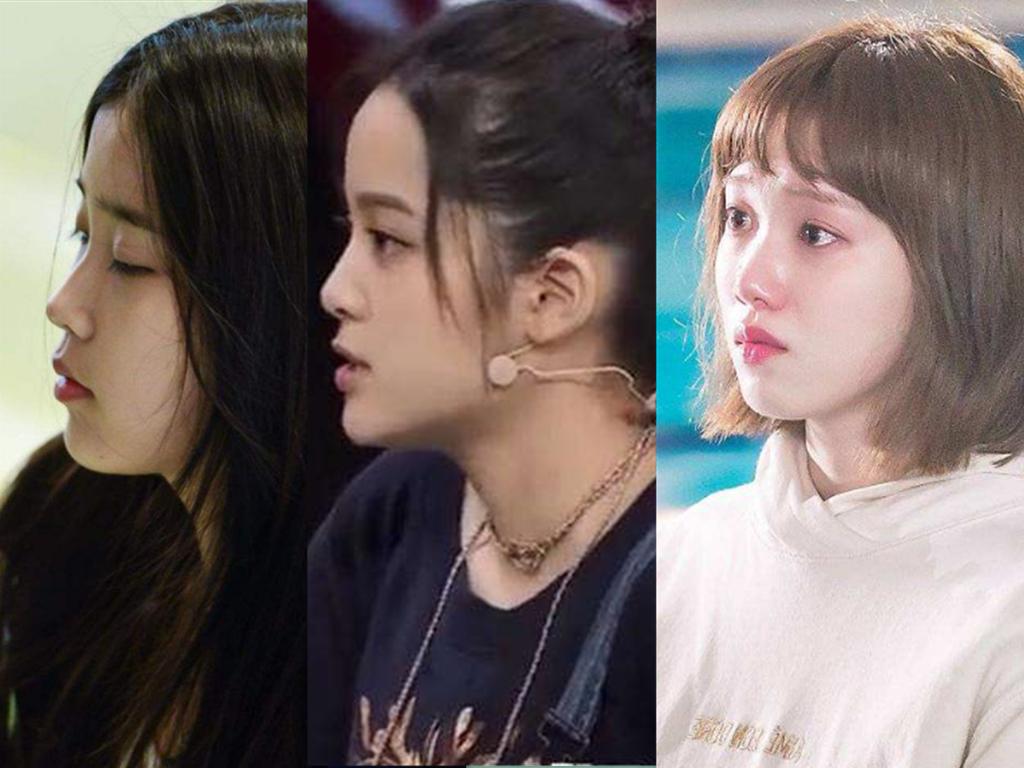 塌鼻子怎么变成方脸,五官扁平塌鼻子如何改善