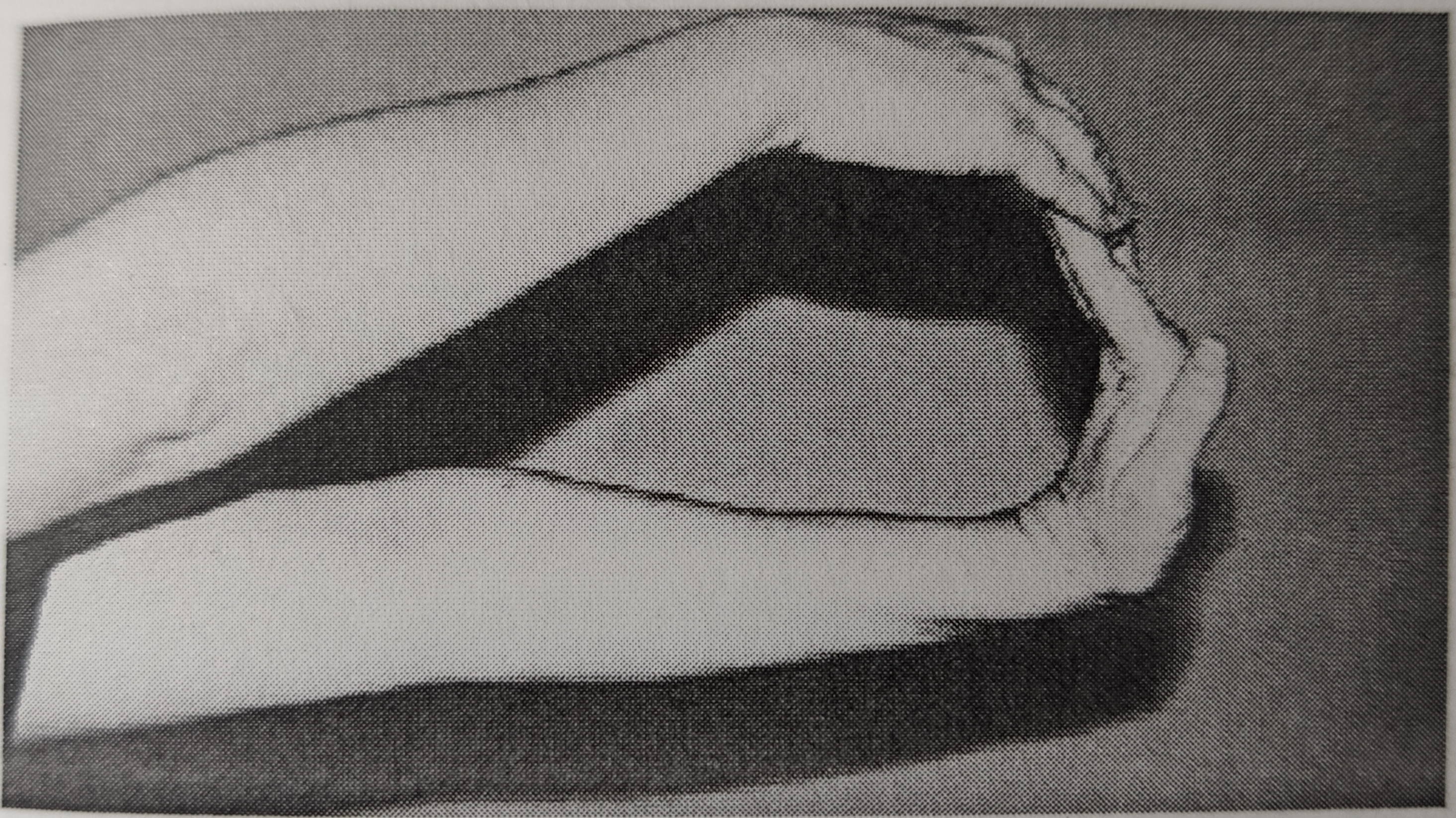 手腕关节疼运动康复训练,缓解手腕痛的运动方法