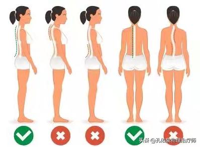 腰疼脊柱侧弯是什么样,腰痛引起的脊柱侧弯原因