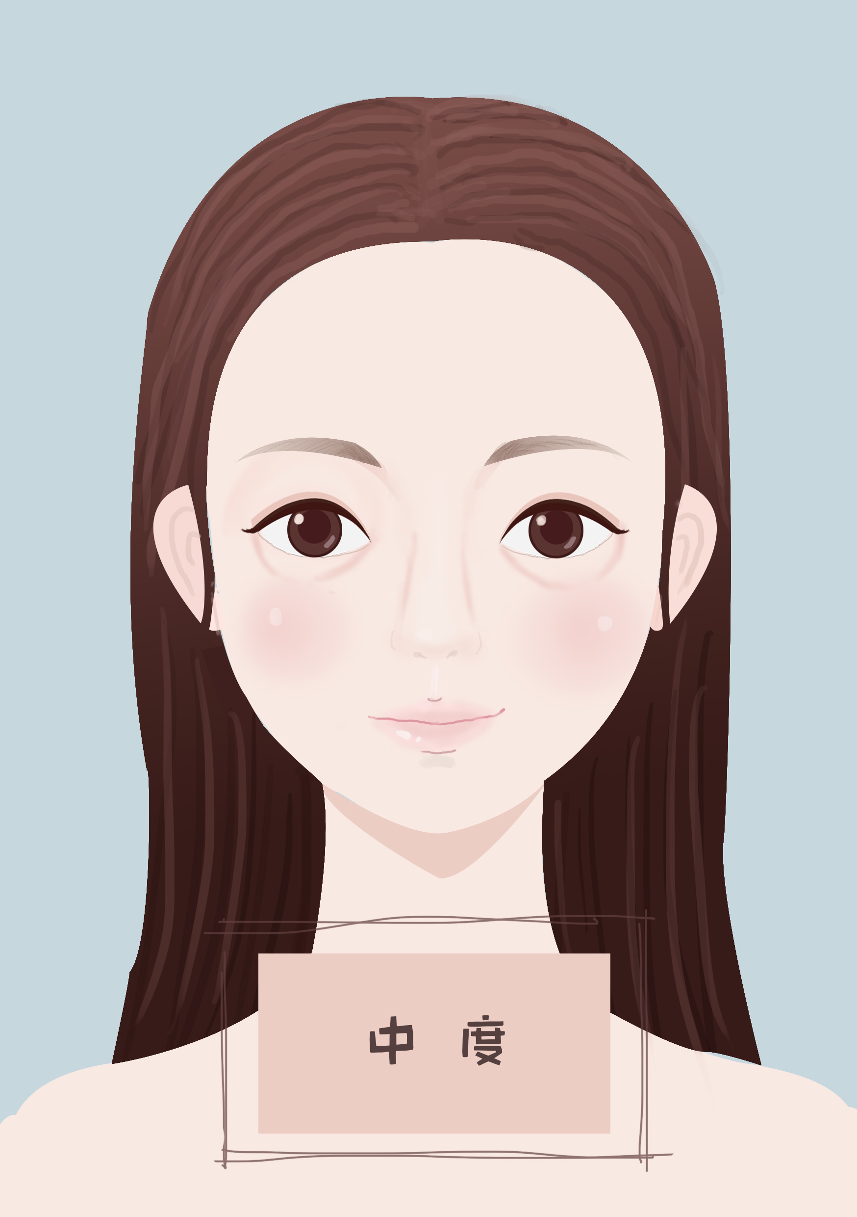 泪沟到底好不好,填了泪沟会不会很丑