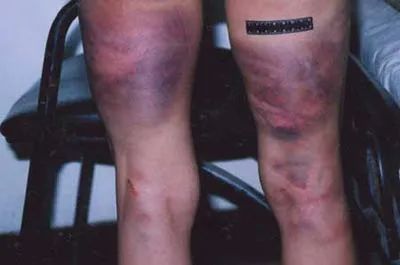 不堪忍受丈夫家暴完整版,不堪丈夫长年家暴后续