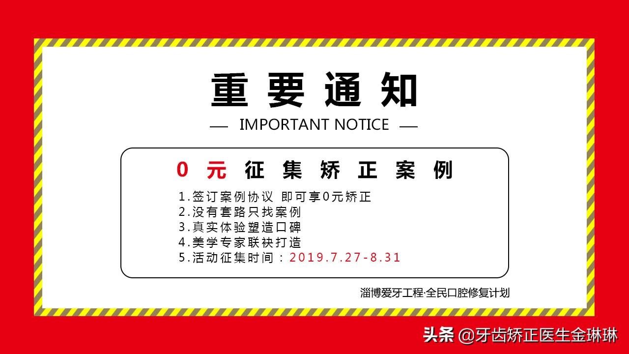 各种牙套的优缺点是什么,各个牙套的优缺点