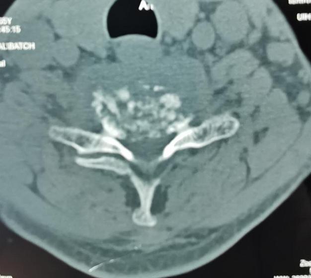 锦州市二医院骨科图片,锦州二医院颈椎手术怎么样