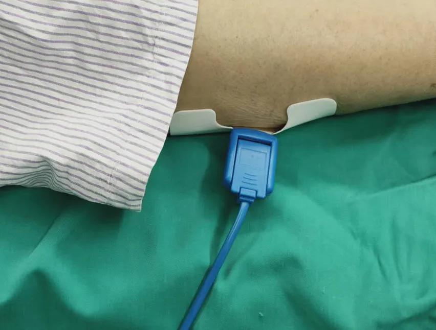 高频电刀最新视频,关于电刀的段子