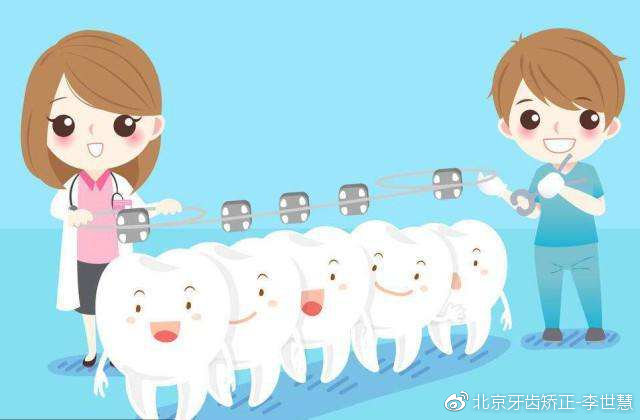 成年后牙齿矫正一般需要多少钱,牙齿矫正大概要花费多少钱成年人