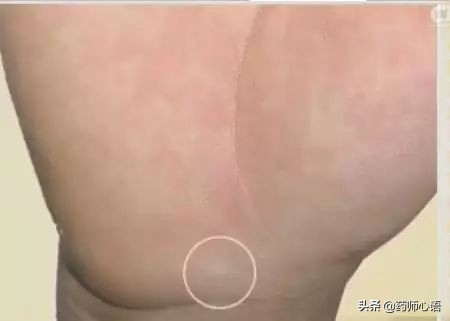 手上的健康秘密,手的颜色能看出健康的问题吗