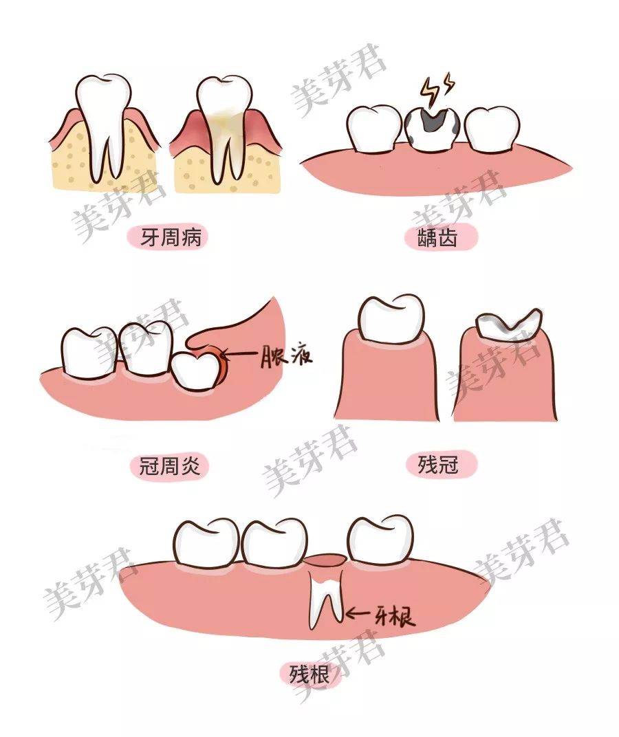 怀孕了牙疼能不能去医院看牙医,牙疼怀孕可以看牙吗