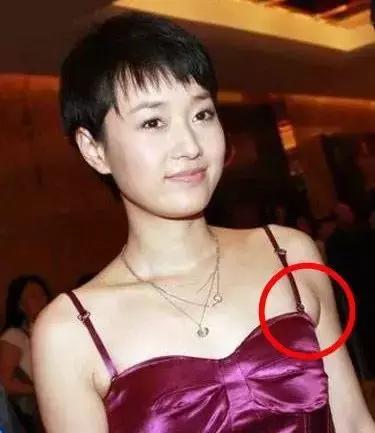 超模收副乳,超模消除副乳